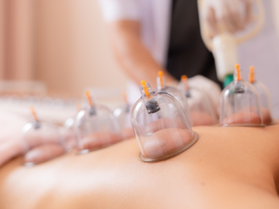Thai Traditional Cupping and Drain Wastes in the Body
